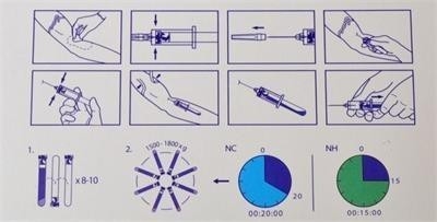 6/8x15ml Przenośny urządzenie PRP 0-4000rpm Do szpitali chirurgii kosmetycznej